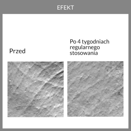 Badania aparaturowe, potwierdzające wygładzający efekt regularnego stosowania kremu pod oczy 4.1 coffee eye już po 4 tygodniach