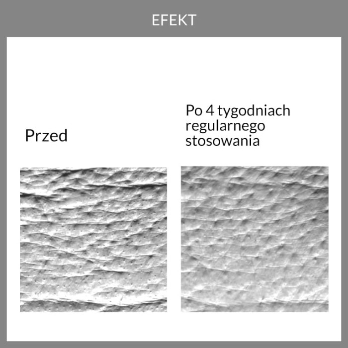 Potwierdzona skuteczność. wyniki badań aparaturowych rewitalizującego kremu Fridge 1.9 serum bomb
