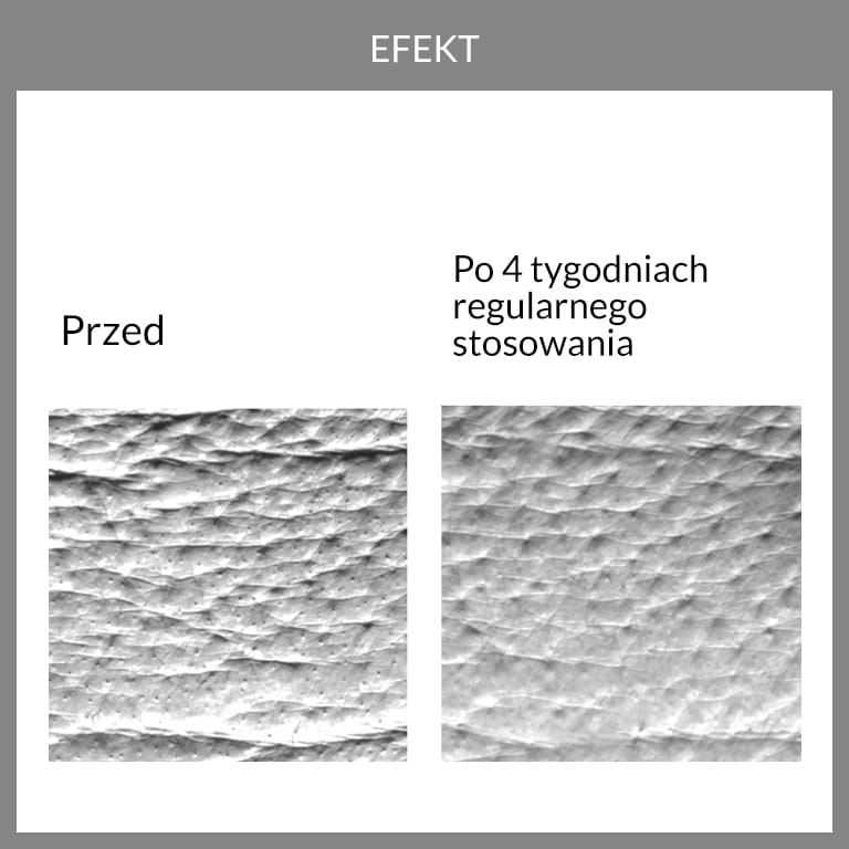 Potwierdzona skuteczność. wyniki badań aparaturowych rewitalizującego kremu Fridge 1.9 serum bomb