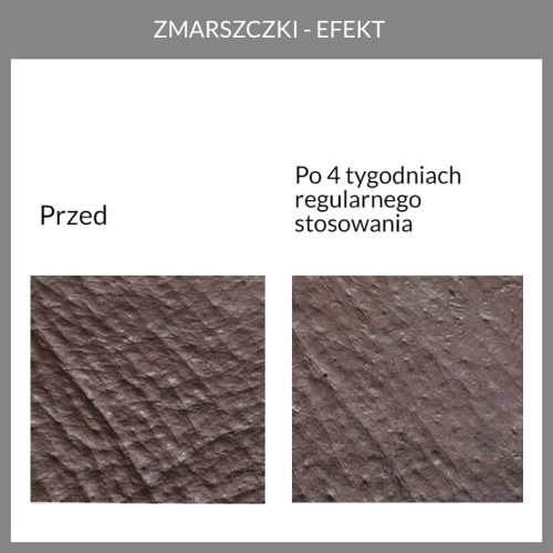 Potwierdzona skuteczność. wyniki badań aparaturowych kremu przeciwzmarszczkowego 1.1 face the cream